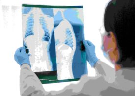 Un medicament aflat în teste a făcut ca celulele canceroase din tumorile pulmonare să se autodistrugă