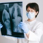 cancer pulmonar inflamatii