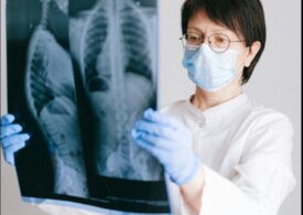 S-a descoperit un potențial factor declanșator al cancerului pulmonar. Boala poate fi prevenită!