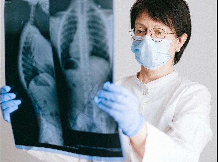 S-a descoperit un potențial factor declanșator al cancerului pulmonar. Boala poate fi prevenită!