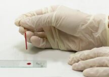 O analiză simplă de sânge ar putea schimba modul în care este diagnosticată boala Alzheimer