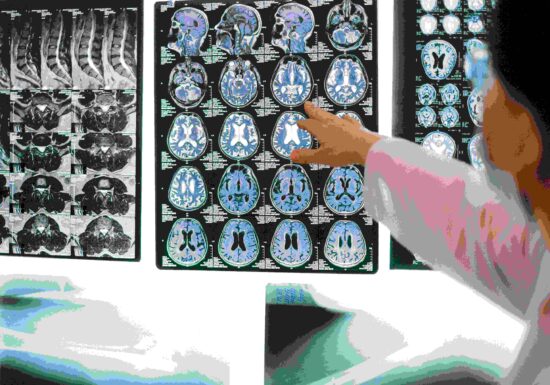 Noi speranțe pentru bolnavii de Alzheimer și familiile lor. Reușită majoră, în laborator