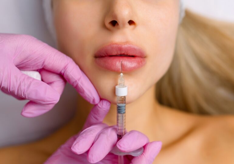 Volumizarea buzelor cu acid hialuronic Amalian: ghid practic pentru cei care doresc o schimbare sigură