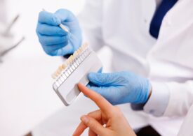 Cum să alegi între fațete dentare din zirconiu și alte opțiuni estetice