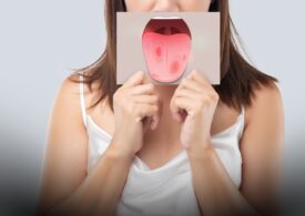 Ai un miros neplăcut chiar și după periaj? 7 motive reale și ce poți face