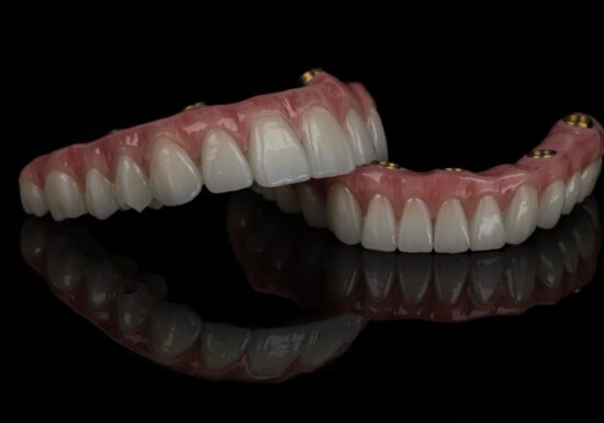 Proteza dentară fixă sau mobilă? Dr. Lupu explică de ce tot mai mulți pacienți aleg varianta fixă pe implanturi