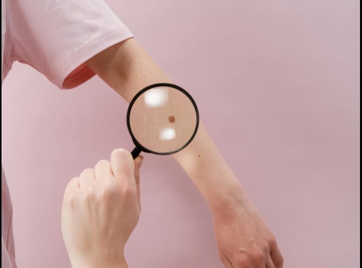 Bronzatul artificial și riscul de cancer. Ce arată cel mai recent studiu și ce efecte are la nivelul ADN-ului