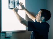 Depresia și osteoporoza, în strânsă legătură. Ce este „axa creier-os”, descoperită de cercetători