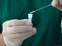 Semnele timpurii de Alzheimer, găsite cu un simplu exsudat nazal, cu ani înainte de apariția tulburărilor de memorie