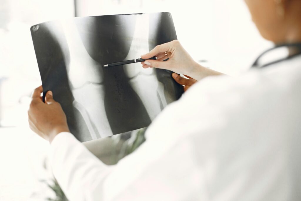Ozempic repară articulațiile afectate de artroză? Ce arată cel mai recent studiu