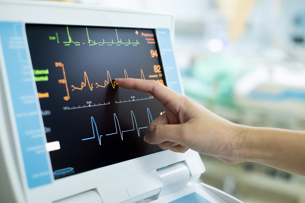 Ecografia cardiacă vs. EKG: care este diferența și când ai nevoie de fiecare?