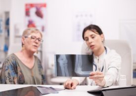 Osteoporoza și sănătatea oaselor: cum le protejezi după 40 de ani