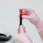 test sange alzheimer Roche