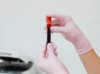 test sange alzheimer Roche