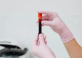 Nou test de sânge pentru diagnosticul bolii Alzheimer, autorizat în UE