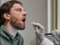 Testul care poate depista cancerul oral într-o oră, fără biopsie