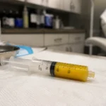 O tendință controversată în chirurgia estetică: grăsimea provenită de la decedați umple golurile lăsate de Ozempic
