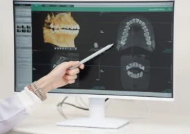 Cum influențează echipamentele de radiologie dentară calitatea diagnosticului?