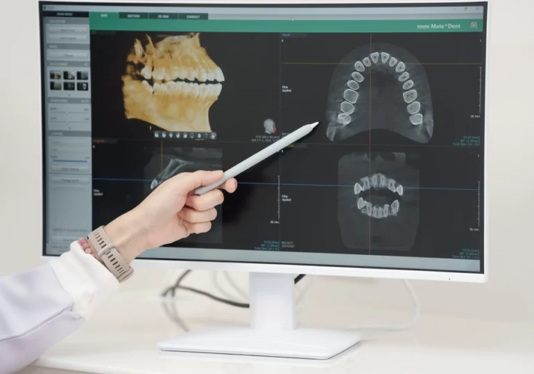 Cum influențează echipamentele de radiologie dentară calitatea diagnosticului?
