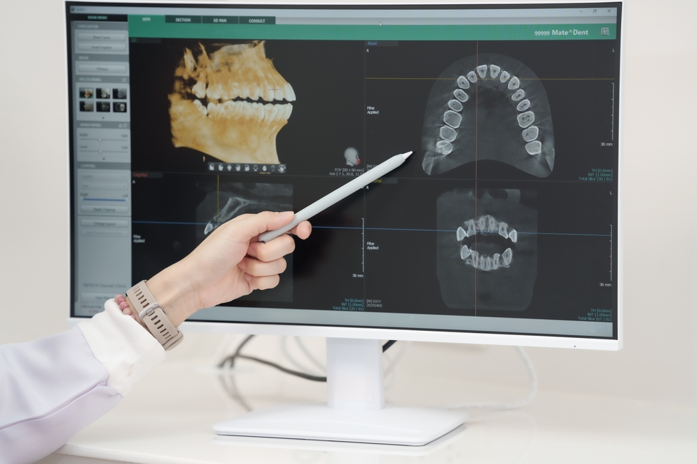 Cum influențează echipamentele de radiologie dentară calitatea diagnosticului?