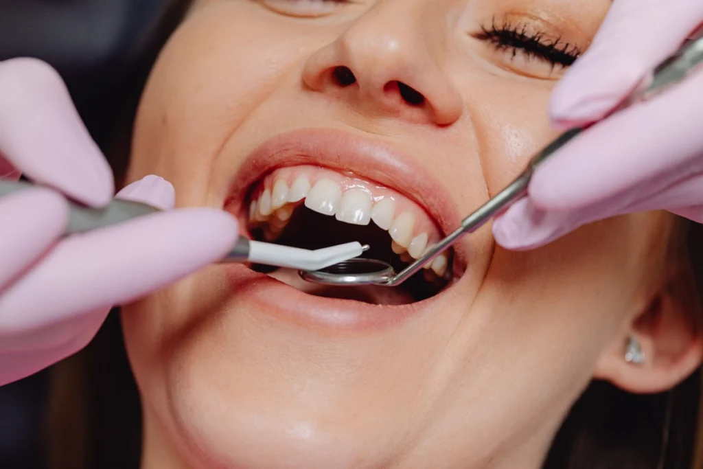 O problemă frecventă a gingiilor, legată de un risc crescut de Alzheimer
