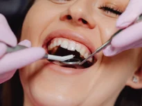 O problemă frecventă a gingiilor, legată de un risc crescut de Alzheimer